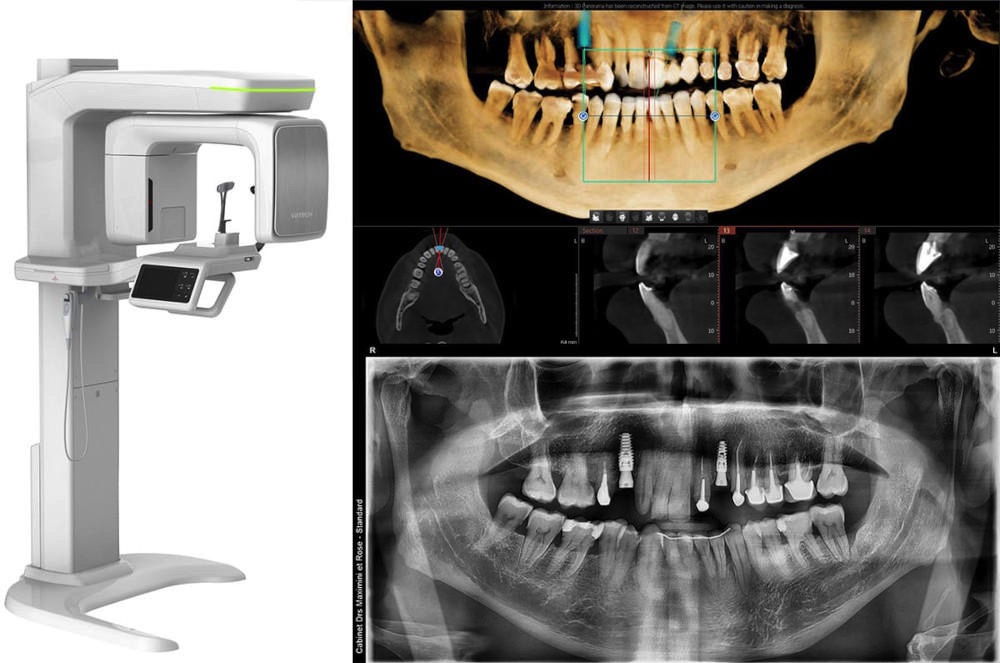 dentistes Strasbourg Cone-beam (scanner)