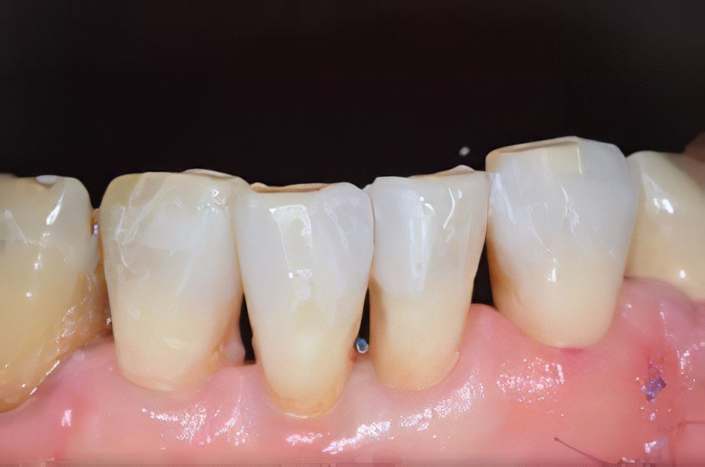 Soins dentaires Strasbourg