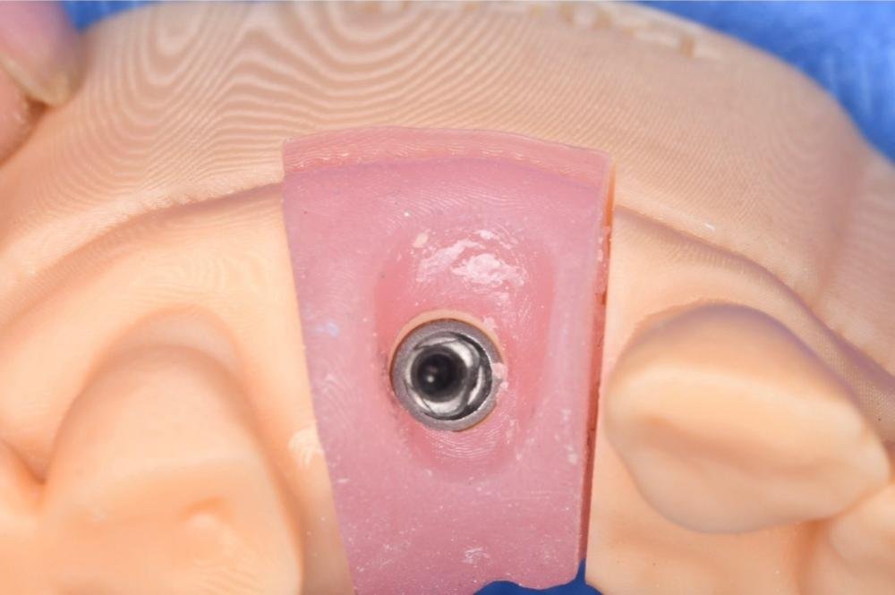 chirurgien dentiste Strasbourg